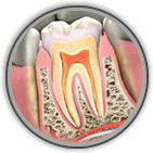 Link to more info about Root Canal