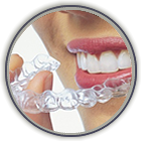 Link to more info about Invisalign
